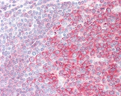 Invitrogen SWAP70 Polyclonal Antibody 100 &mu;g; Unconjugated:Antibodies,