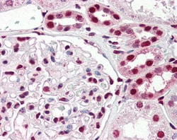 Invitrogen IRF6 Polyclonal Antibody 100 &mu;g; Unconjugated:Antibodies,