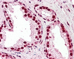 Invitrogen IRF6 Polyclonal Antibody 100 &mu;g; Unconjugated:Antibodies,
