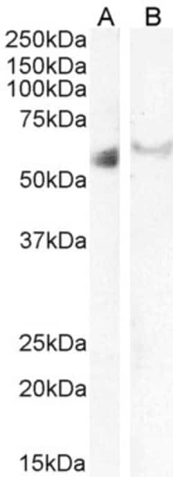 Invitrogen IRF6 Polyclonal Antibody 100 &mu;g; Unconjugated:Antibodies,