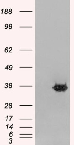 Invitrogen MORF4L2 Polyclonal Antibody 100 &mu;g | Buy Online | Invitrogen&trade; | Fisher Scientific