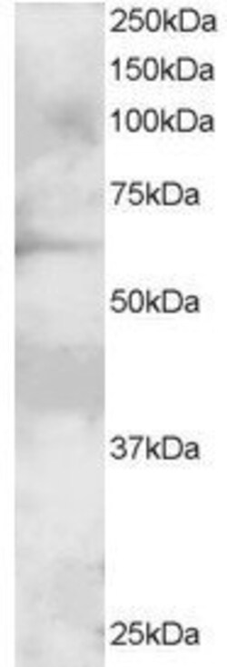 Invitrogen GRB7 Polyclonal Antibody 100 &mu;g; Unconjugated:Antibodies,