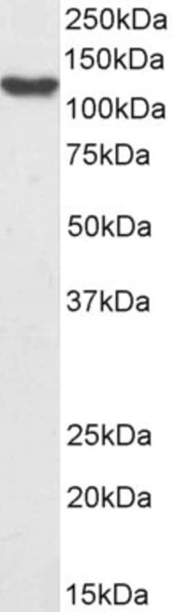 Invitrogen HLTF Polyclonal Antibody 100 &mu;g; Unconjugated:Antibodies,