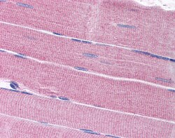 Invitrogen SORBS1 Polyclonal Antibody 100 &mu;g; Unconjugated:Anticuerpos