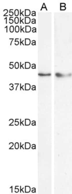 Invitrogen KLF15 Polyclonal Antibody 100 &mu;g | Buy Online | Invitrogen&trade; | Fisher Scientific