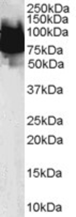 Invitrogen KLF4 Polyclonal Antibody 100 &mu;g; Unconjugated:Antikörper