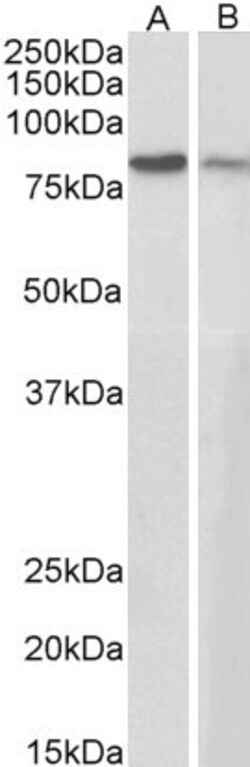 Invitrogen gamma Catenin Polyclonal Antibody 100 μg; Unconjugated:Antibodies,