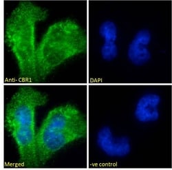 Invitrogen CBR1 Polyclonal Antibody 100 &mu;g; Unconjugated:Antibodies,