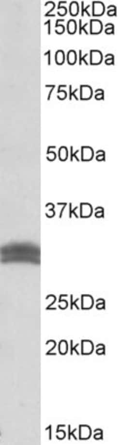 Invitrogen CBR1 Polyclonal Antibody 100 &mu;g; Unconjugated:Antibodies,