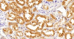 Invitrogen AKR1A1 Polyclonal Antibody 100 &mu;g; Unconjugated:Antibodies,