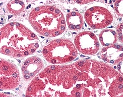 Invitrogen AKR1A1 Polyclonal Antibody 100 &mu;g; Unconjugated:Antibodies,