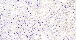 Invitrogen AKR1A1 Polyclonal Antibody 100 &mu;g; Unconjugated:Antibodies,