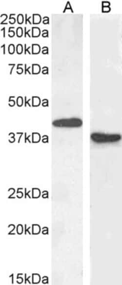 Invitrogen PAX5 Polyclonal Antibody 100 &mu;g; Unconjugated:Antibodies,