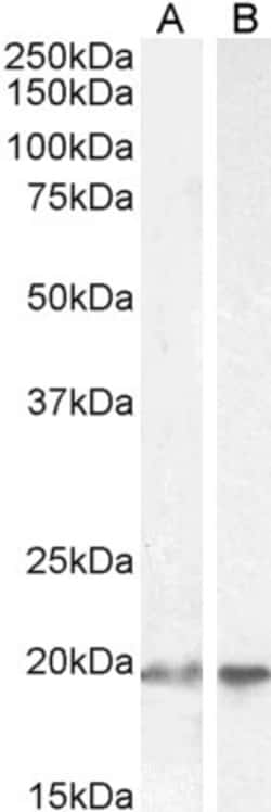 Invitrogen UBE2C Polyclonal Antibody 100 &mu;g; Unconjugated:Antibodies,