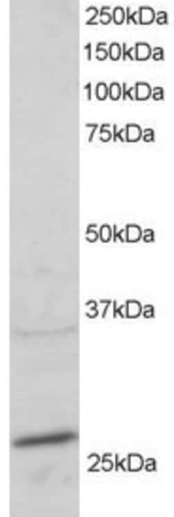 Invitrogen RAB11A Polyclonal Antibody 100 &mu;g; Unconjugated:Antibodies,