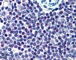 Invitrogen HMG20A Polyclonal Antibody 100 &mu;g; Unconjugated:Antibodies,