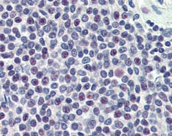 Invitrogen HMG20A Polyclonal Antibody 100 &mu;g; Unconjugated:Antibodies,