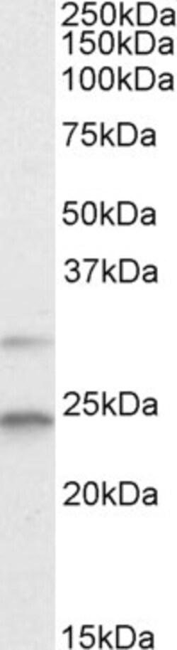 Invitrogen MAD2 Polyclonal Antibody 100 &mu;g | Buy Online | Invitrogen&trade; | Fisher Scientific