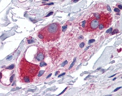 Invitrogen JWA Polyclonal Antibody 100 &mu;g; Unconjugated:Antibodies,