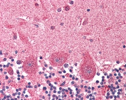 Invitrogen Dynactin 1 Polyclonal Antibody 100 &mu;g; Unconjugated:Antibodies,