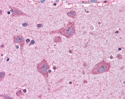 Invitrogen ACSL4 Polyclonal Antibody 100 &mu;g; Unconjugated:Antibodies,
