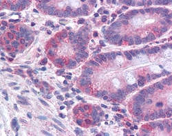 Invitrogen ACSL4 Polyclonal Antibody 100 &mu;g; Unconjugated:Antibodies,