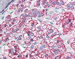 Invitrogen ACADM Polyclonal Antibody 100 &mu;g; Unconjugated:Antibodies,