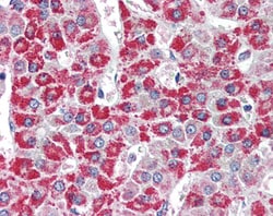 Invitrogen ACADM Polyclonal Antibody 100 &mu;g; Unconjugated:Antibodies,