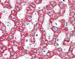 Invitrogen ACADM Polyclonal Antibody 100 &mu;g; Unconjugated:Antibodies,