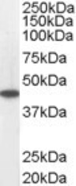 Invitrogen ACADM Polyclonal Antibody 100 &mu;g; Unconjugated:Antibodies,