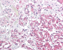 Invitrogen HSPB8 Polyclonal Antibody 100 &mu;g; Unconjugated:Antibodies,