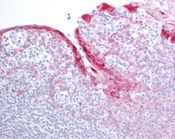 Invitrogen HSPB8 Polyclonal Antibody 100 &mu;g; Unconjugated:Antibodies,
