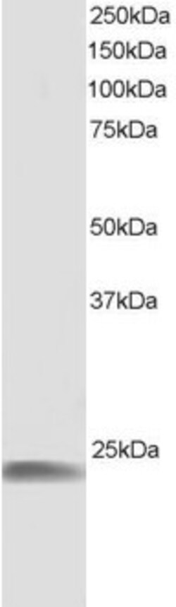 Invitrogen HSPB8 Polyclonal Antibody 100 &mu;g; Unconjugated:Antibodies,