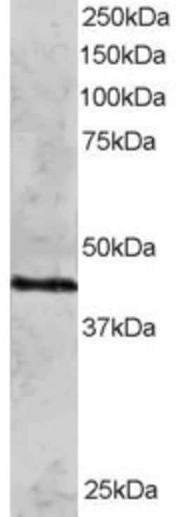 Invitrogen RAD51C Polyclonal Antibody 100 &mu;g; Unconjugated:Antibodies,