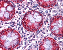 Invitrogen NDRG1 Polyclonal Antibody 100 &mu;g; Unconjugated:Antibodies,