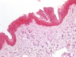Invitrogen NDRG1 Polyclonal Antibody 100 &mu;g; Unconjugated:Antibodies,