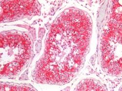 Invitrogen NDRG1 Polyclonal Antibody 100 &mu;g; Unconjugated:Antibodies,