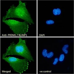 Invitrogen Blimp-1 Polyclonal Antibody 100 &mu;g; Unconjugated:Antibodies,
