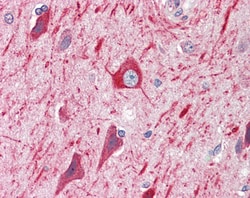 Invitrogen PRDM11 Polyclonal Antibody 100 &mu;g; Unconjugated:Antibodies,