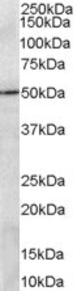 Invitrogen PRDM11 Polyclonal Antibody 100 &mu;g; Unconjugated:Antibodies,