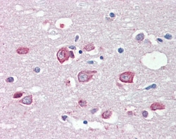 Invitrogen MLL4 Polyclonal Antibody 100 &mu;g; Unconjugated:Antibodies,