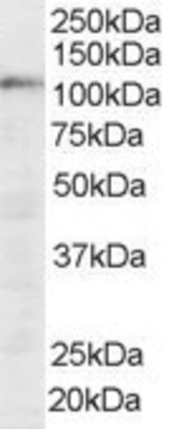Invitrogen SART1 Polyclonal Antibody 100 &mu;g; Unconjugated:Antibodies,