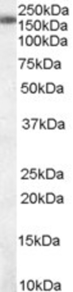 Invitrogen SART3 Polyclonal Antibody 100 μg; Unconjugated:Antibodies,