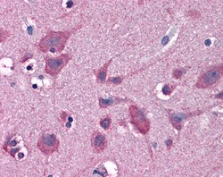 Invitrogen HIP2 Polyclonal Antibody 100 &mu;g; Unconjugated:Antibodies,