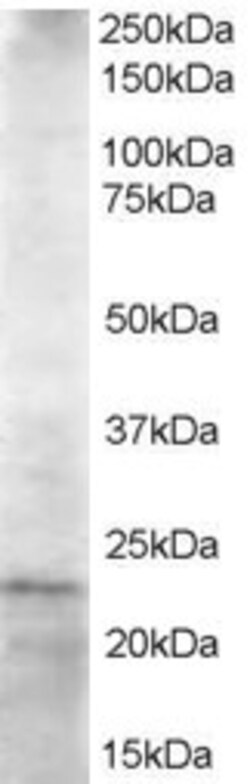 Invitrogen HIP2 Polyclonal Antibody 100 &mu;g; Unconjugated:Antibodies,