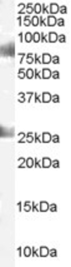 Invitrogen CDYL Polyclonal Antibody 100 &mu;g; Unconjugated:Antibodies,