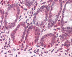 Invitrogen BAZ2B Polyclonal Antibody 100 &mu;g; Unconjugated:Antibodies,