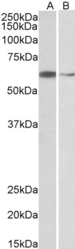 Invitrogen ARIH2 Polyclonal Antibody 100 &mu;g; Unconjugated:Antibodies,