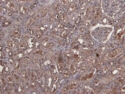 Invitrogen MID2 Polyclonal Antibody 100 &mu;g; Unconjugated:Antibodies,