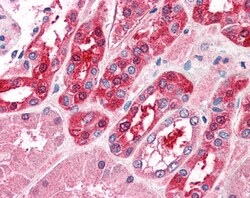 Invitrogen MID2 Polyclonal Antibody 100 &mu;g; Unconjugated:Antibodies,